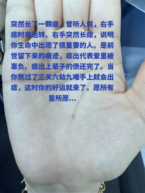 右手手臂有痣|右手突然长痣代表什么 老人说右手突然长痣代表什么 